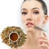 loose tea, herbal blend for acne, herbal tea, herbs for acne action, antibacterial tea, anti-inflammatory tea for acne